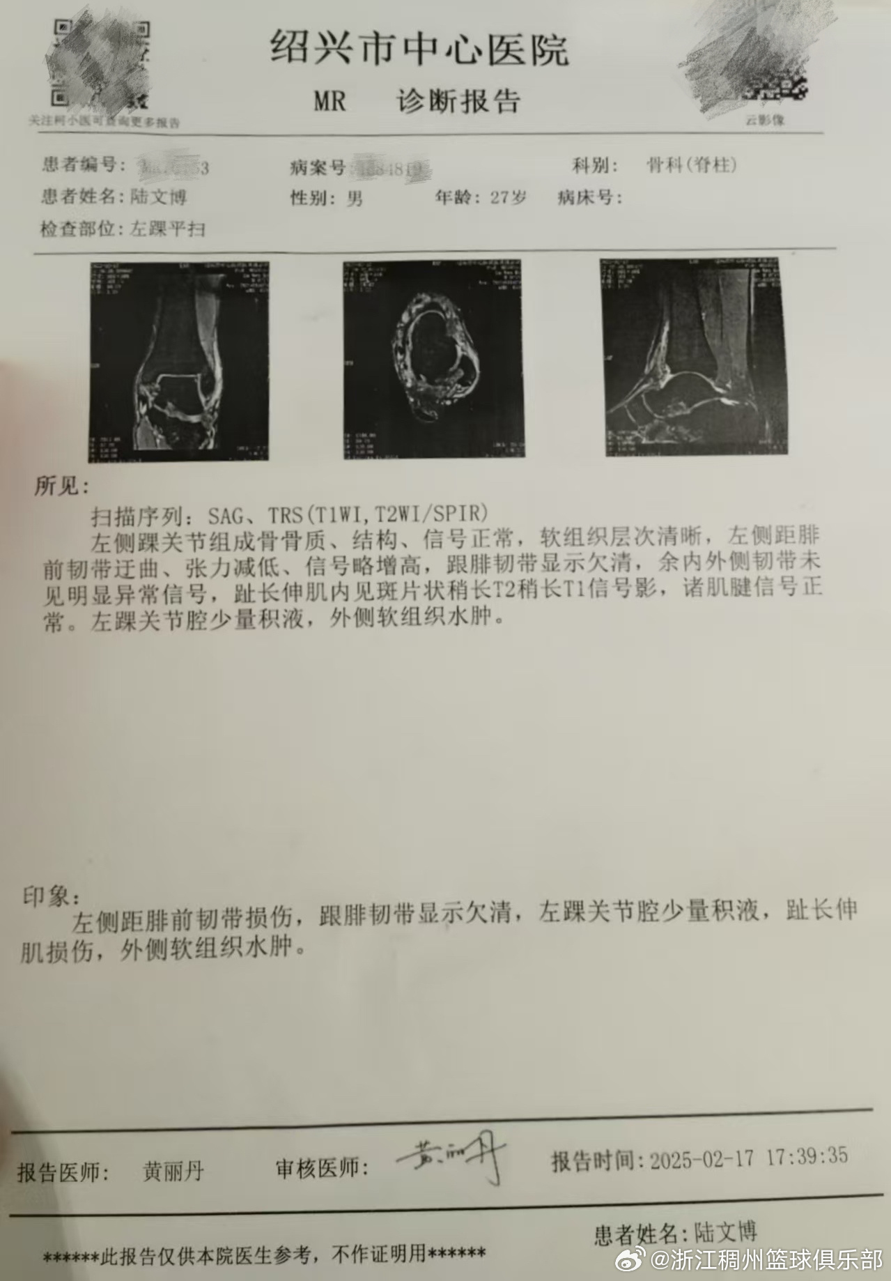 僅是在防守